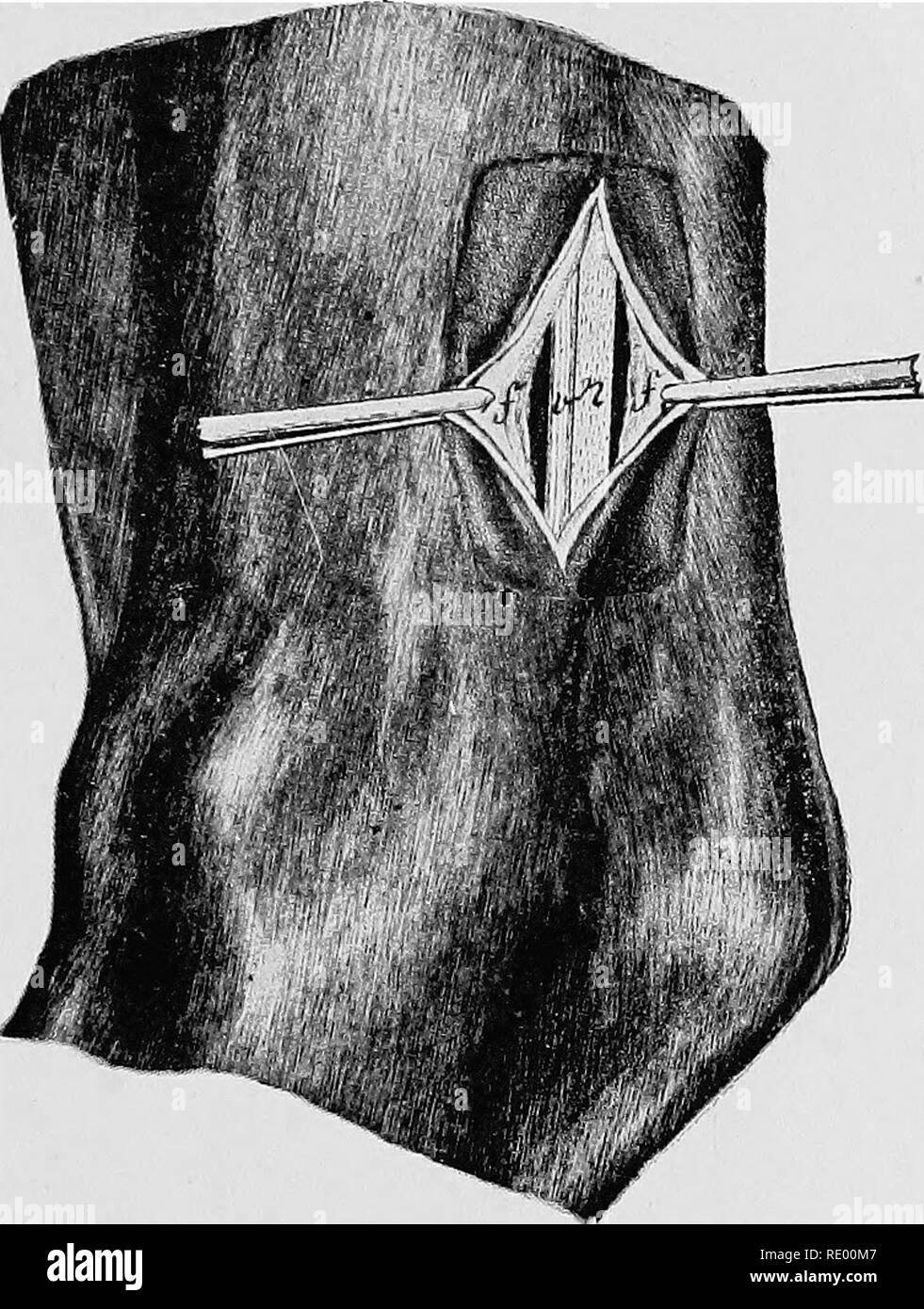 . Les opérations chirurgicales et obstétriques. Chirurgie vétérinaire. Neurectomie sciatique perforans muscle et entre ce dernier et le tendo-Achilles le nerf, près de i cm. de diamètre, glisse loin de l'avant d'entre les doigts avec un net recul. Si le nerf ne peut être reconnu de cette manière, le jarret doit être plus fortement étendu, par quels moyens il peut être dû à. FIG. 57 Neurectomie sciatique jambe arrière droite vue à partir de la médiane, côté / fascia Crural ; ", nerf sciatique (nerf tibial) ; v, veine plantaire. diminuer par rapport au muscle perforans, de sorte qu'il peut plus facilement se faire sentir vers le milieu de la gro Banque D'Images