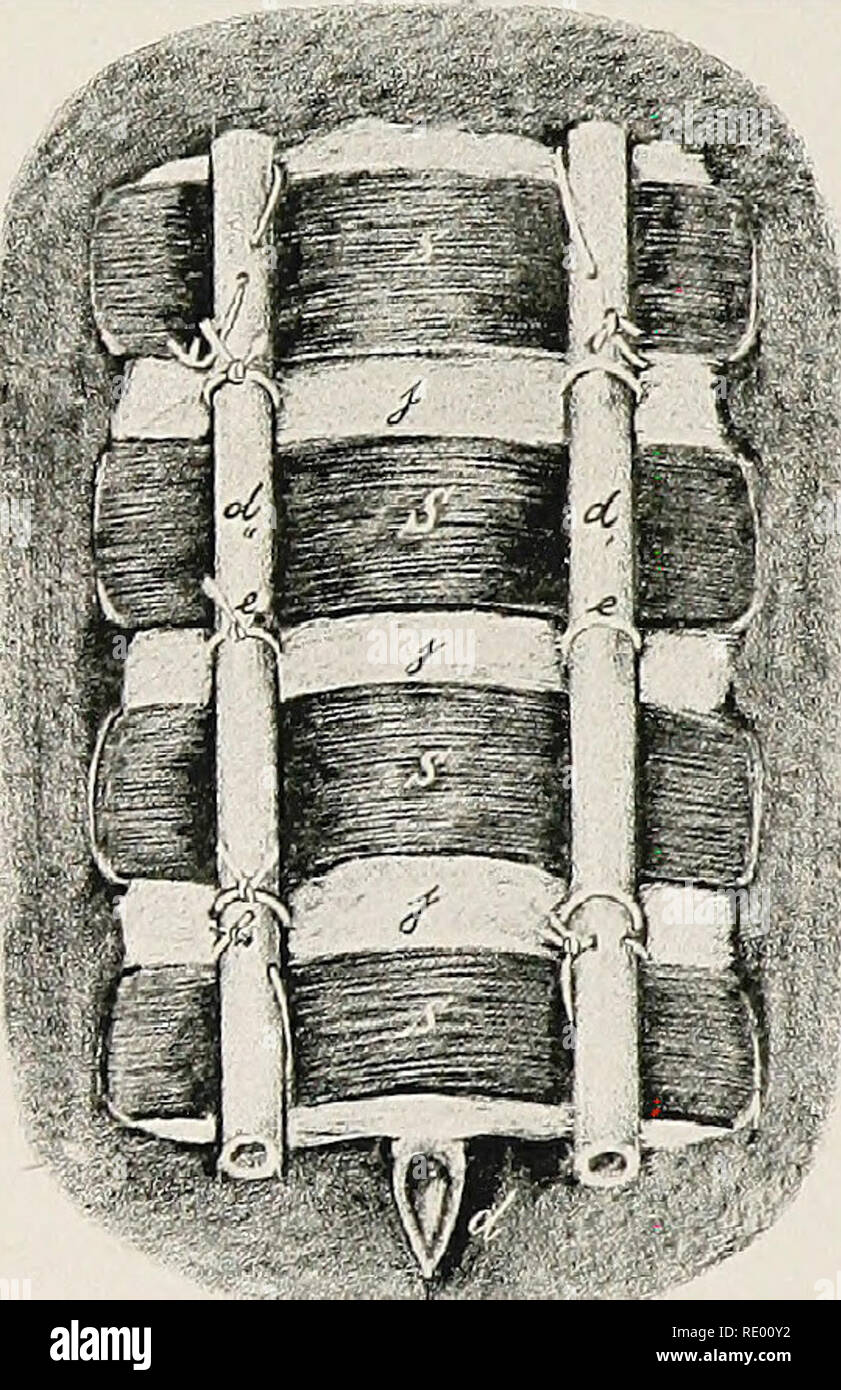 . Les opérations chirurgicales et obstétriques, pour les étudiants et les praticiens vétérinaires. Chirurgie vétérinaire. i8o LA BA YER attelles. SUTURE 15 cm. de long, 2 à 4 cm. de large, avec rpunded se termine ; gaze iodoforme iodoforme ; ether 1:10. Technic. Après que la peau lias été rasée sur une zone ayant un rayon de 5 à 6 cm. à partir de la blessure, la suture aiguille est insérée 2 à 3 cm. de la bouche à travers la peau et les tissus sous-jacents, un tube de drainage, d', adopté. Fig. 14. Bandage. Spwnt d, d', d", les tubes de drainage ; e, la conservation (extrémité fermée) ; e', n, J, l'extrémité ouverte de la gaze iodoforme ; .s, à travers les attelles. Banque D'Images
