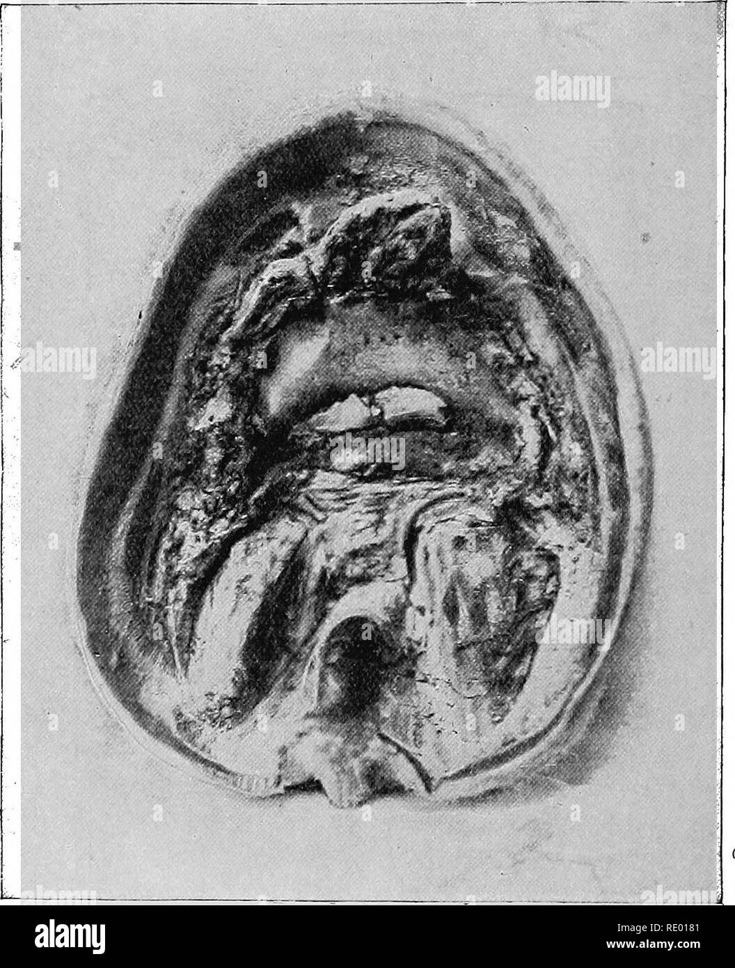 . Les maladies du pied du cheval . Sabots ; chevaux. 400 LES MALADIES DE L'HOESE talon du pied au sol et "secoué la toe," comme dans un cas de rupture du tendon perforans. La mare a été tué le 13 juin. ' Post-mortem.-En essayant de retirer le pied de la. Fig. 157.-Feaoture du processus pyramidal à pied. Renforcer les structures sensibles avec une paire de tenailles de maréchal-ferrant, les tendons et ligaments de l'articulation de la pédale-$ Corono a cédé, laissant l'os de la pédale in situ. Le tendon fléchisseur perforans ramollissement inflammatoire a montré, et était très près par rupture au niveau de Banque D'Images