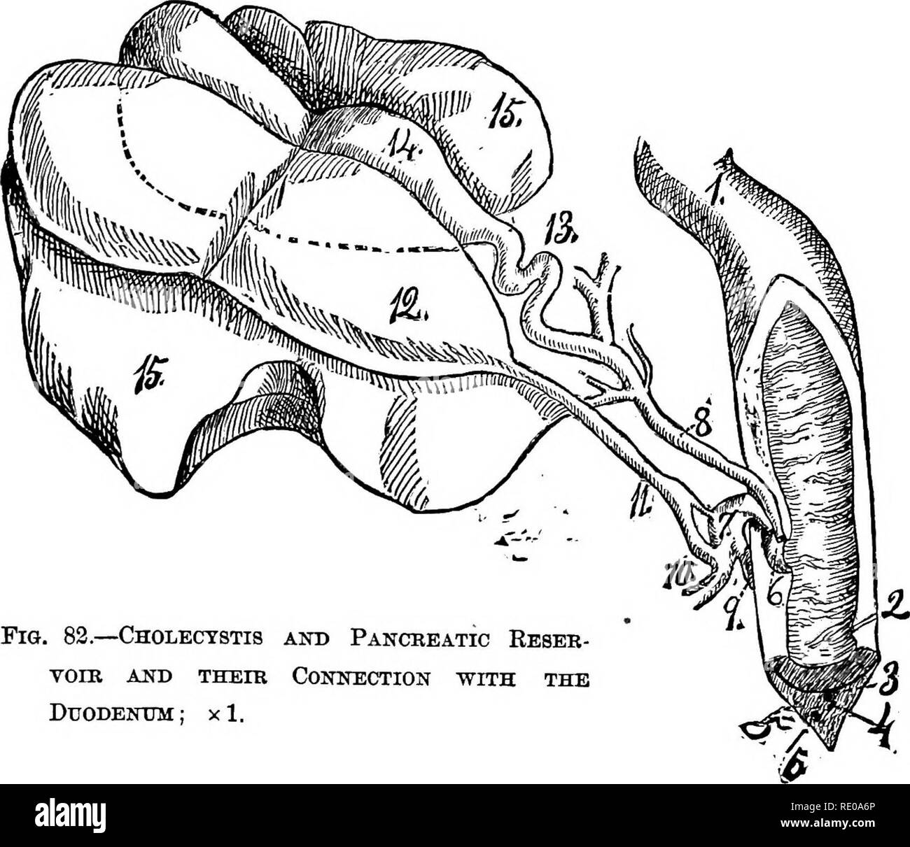 . La technologie appliquée à l'anatomie le chat domestique ; une introduction à usage humain et vétérinaire, et l'anatomie comparée. La dissection ; chats ; les mammifères. CHOLECYSTIS PANCRÉATIQUE ET RÉSERVOIR. 289 deux-points et le foie ont été supprimés ; le reste des pièces illustrées in situ. Le conduit d'Wirsnng a été ensuite injecté avec Berlin, bleu et les deux il et le conduit de Santorini disséqués pour montrer leurs branches et anastomoses. Explication de la Fig. 8i.-1. ^ stomacli de région pylorique. 2. Pylore. 3-3. Le duodénum. 4. Qastro-division de la rate du pancréas, à proximité de la principale branche de l' air de Wirsung. 5. L'duode Banque D'Images