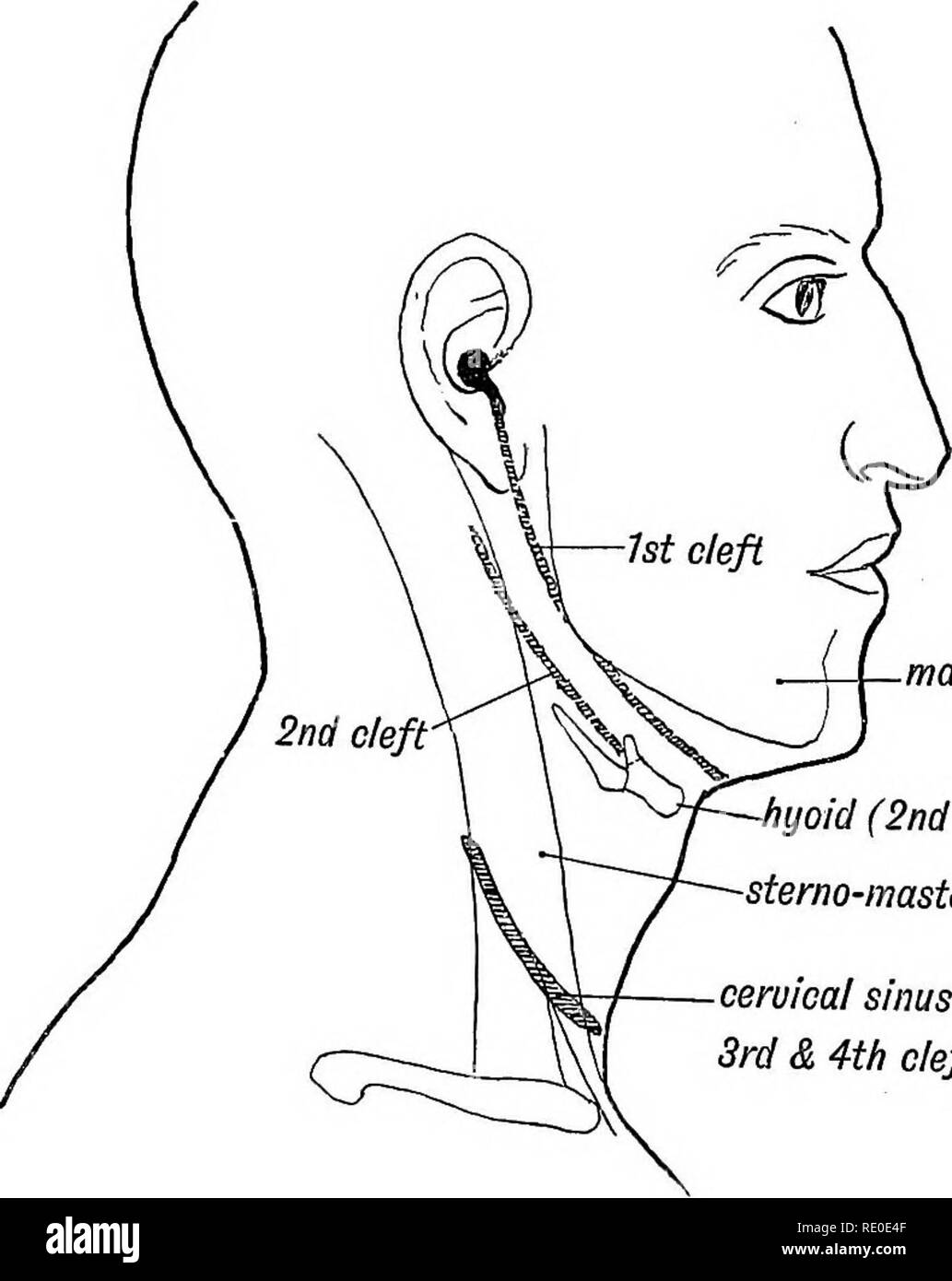 . Les droits de l'embryologie et de morphologie. L'embryologie, l'homme ; la morphologie. 32 LES DROITS DE L'embryologie et de morphologie. Formation du sinus Cervical.-Le premier arc en particulier, et aussi le deuxième, se développer et d'augmenter beaucoup plus rapidement que les troisième et quatrième. Il est observé que le deuxième arc (arc hyoïdien) qui dans l'opercule formes poissons pour les branchies, pousse sur et enterre les troisième et quatrième. Comme il couvre plus de et entre en contact avec la paroi du corps derrière la cinquième roue (voir A et B, Fig. 23), l'épiblaste couvrant des troisième et quatrième arcs et de crevasses est enterré. L'épiblaste et formulaire ci-joint Banque D'Images