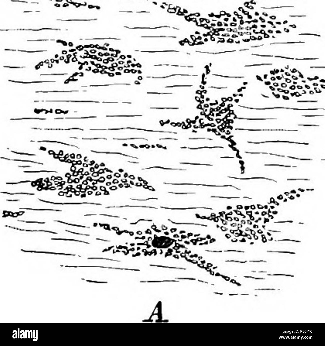 . Physiologie générale ; un aperçu de la science de la vie. 336 physiologie générale a constaté, par exemple, dans le cerveau d'idiots, " pétrifié" les cellules ganglionnaires-dans le vrai sens du mot (Fig. 149, B). Outre les formes de processus métamorphiques ici présenté, la pathologie reconnaît d'autres, telles que le pigment-atro;phy, dégénérescence hyaline, métamorphose de colloïdes, etc., à la base de laquelle il y a toujours le même principe, à savoir que le méta- bolism des cellules prend un cours pervers, et forme des substances qui sont normalement formées soit pas du tout ou seulement en légère quantité, le résultat final Banque D'Images