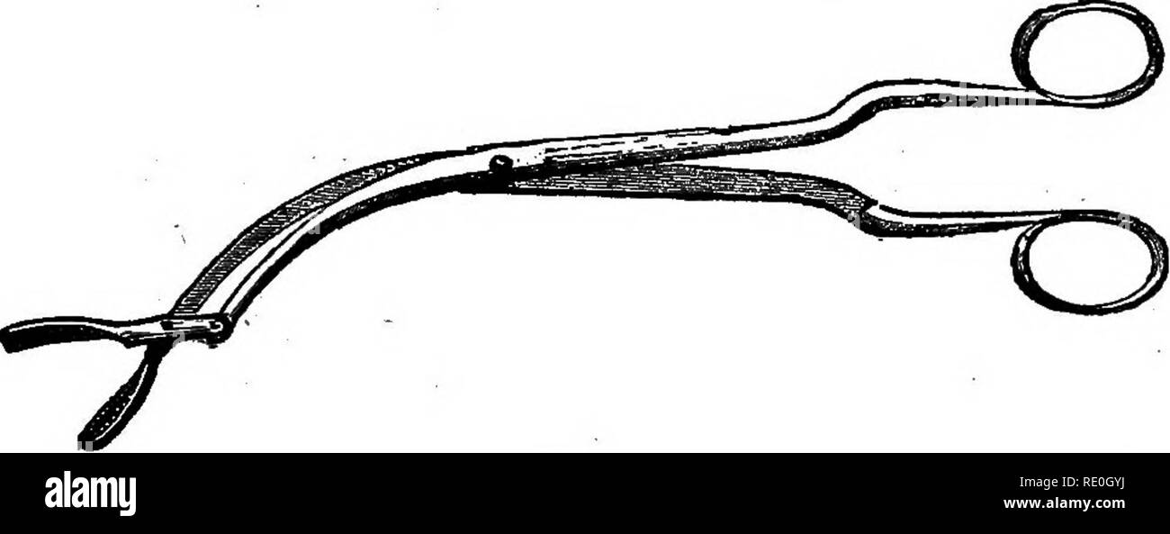 Points de suture enlevés Banque d'images noir et blanc Alamy