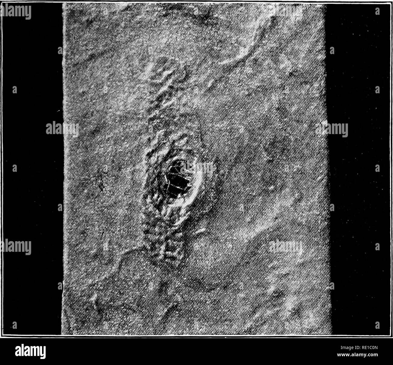 . Un texte-livre sur les protozoaires et les bactéries pathogènes pour les étudiants de médecine et les médecins. Bactériologie ; bactéries pathogènes ; les protozoaires. Pathogenèse 637 il y a toujours le sang et bien marqué l'infection pendant les premières semaines de la maladie, et sur ceci^ dépendent de l'occurrence de la rose-points colorés. Les bacilles entrez les glandes solitaires et plaques de Peyer, et multiplier lentement au cours de la période d'incubation de la maladie, une à trois semaines. Le résultat immédiat de leur activité dans les structures est une augmentation du nombre de cellules, l'effet final est la nécrose et desquamation Banque D'Images