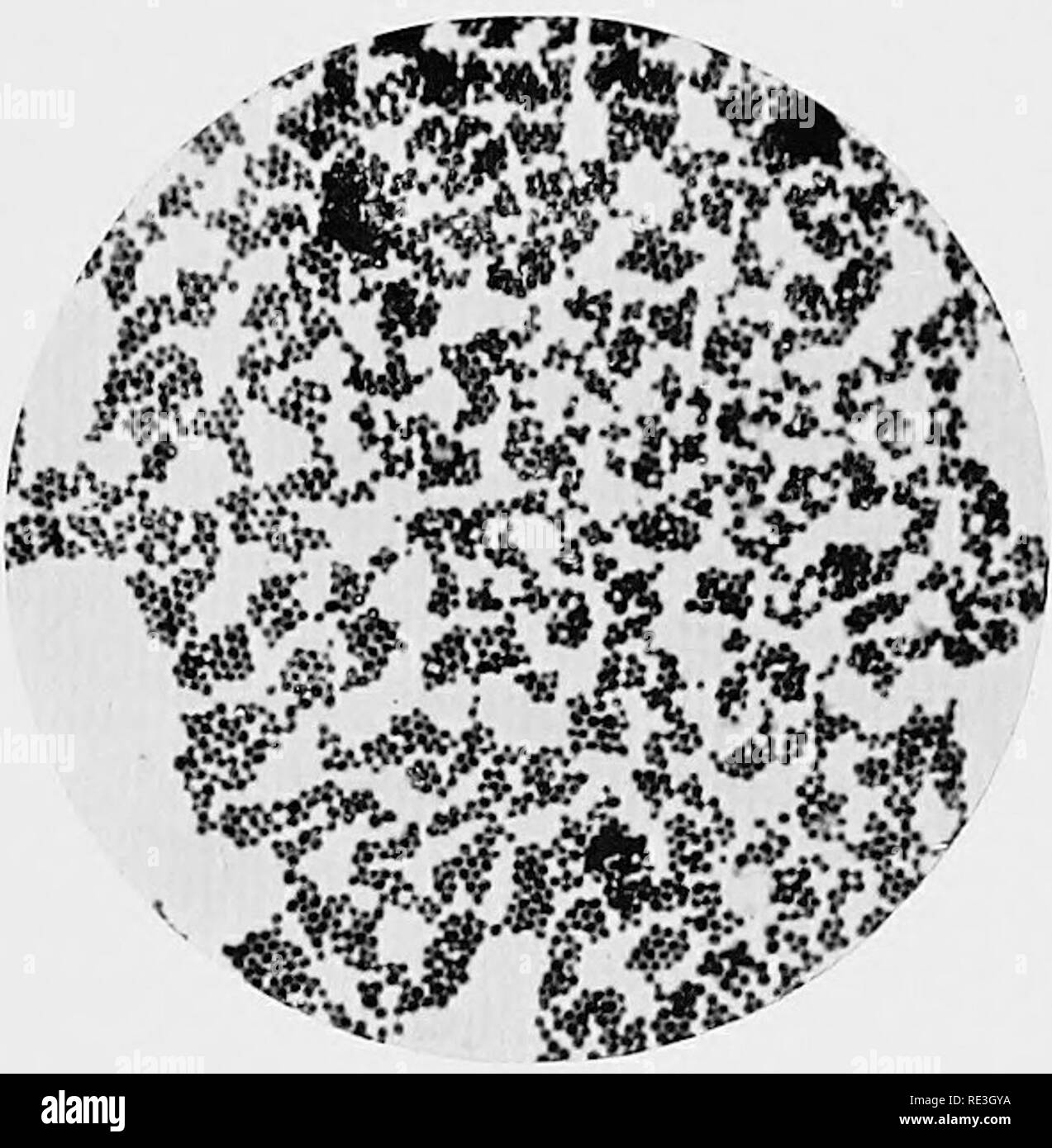 . La bactériologie et la santé publique. Bactériologie ; santé publique. Bacille de la peste (ij. peHis hiiljonicm). À partir de foie de rats pestiférés. X 1000.. ^taphylucoceus^ jti/ogmt : aumis. X 1000. [Pour faire face à la page 398.. Veuillez noter que ces images sont extraites de la page numérisée des images qui peuvent avoir été retouchées numériquement pour plus de lisibilité - coloration et l'aspect de ces illustrations ne peut pas parfaitement ressembler à l'œuvre originale.. Newman, George, Sir, 1870-1948. Philadelphie, P. le Fils &AMP ; Co. Banque D'Images