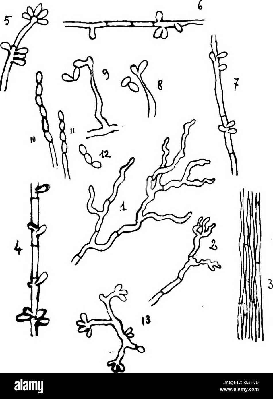 . Les micro-organismes pathogènes. Un texte-livre de microbiologie pour les médecins et les étudiants en médecine. (D'après Williams' bactériologie). Bactériologie ; les bactéries pathogènes. Les moisissures ET LES LEVURES ET LES MALADIES CAUSÉES PAR EUX 251 Sporotrichtim Schencki.-Schenck, à Baltimore en 1898, décrites ce moule parasitaires qu'il a trouvé dans les lésions d'un. Cochon. 103.-Sporotrichum schenki. Diverses formes de mycélium, avec et sans des conidies. (Après Gougerot.) maladie particulière, commençant comme un ulcère localisé, avec participation des ganglions voisins, de l'abcès. Veuillez noter que ces Banque D'Images