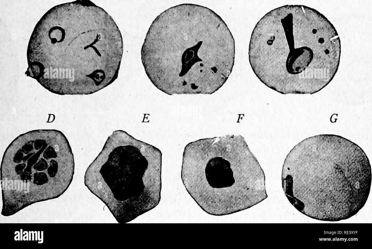 . Les micro-organismes pathogènes. Un texte-livre de microbiologie pour les médecins et les étudiants en médecine. (D'après Williams' bactériologie). Bactériologie ; les bactéries pathogènes. SPOROZOA Centre 439, donnant le parasite l'apparence d'une chevalière, les êtres humains l'établissement représenté par le noyau ou des granules de chromatine. Fig. 199.-Plasmodium falciparum, formes dans le cycle de multiplication asexuée (schizogonie). Une infection de multiples, un érythrocyte, montrant chevalières et parasites attachés à la surface externe. B et C, les parasites de plus en plus avec les granules Mauer dans les érythrocytes. D, sans parasite croissant granu Banque D'Images