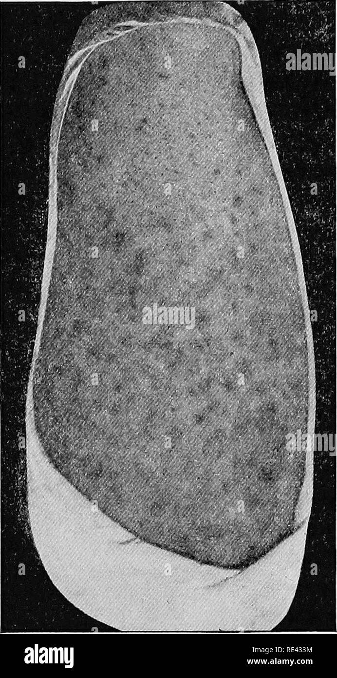 . Manuel de l'entomologie médicale. Les insectes nuisibles ; les insectes porteurs de la maladie ; parasitologie médicale. 86 arthropodes parasites et sont fournis avec des griffes puissantes équipé pour s'accrocher à poils. Les femelles (fig. 69) mesure 1,5 à 2 mm de longueur par 1,5 mm. de largeur. Le mâle est en moyenne un peu plus de moitié. Les oeufs, ou lentes, sont fixés à la base des poils. Seul un petit nombre, 10 à 15 sont déposés par une seule femme, et qu'ils éclosent après environ une semaine. Le jeune Hce à maturité en deux semaines. Le pou du pubis infeste généralement les poils du pubis et la région périnéale. Il peut passer à Banque D'Images