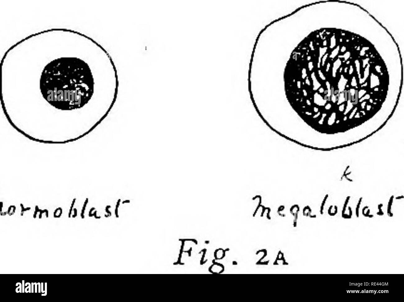 . L'étude pratique de la malaria et d'autres parasites du sang. Le paludisme, les moustiques ; Trypanosoma ; du sang. 20 Ces cellules se produire que des spécimens isolés dans le sang normal. Ils forment à propos de o"5  %, de toutes les cellules blanches. 3. Plaquettes (Fig. 2).-Organes de différentes tailles jusqu'à un tiers du diamètre de la cellule rouge, presque toujours. couché dans des touffes de de six à cinquante, et lumineux vitraux : Crimson. Elles montrent souvent une quantité considérable de- coloration différentielle, mais diffèrent entièrement de l'apparence de parasites, plus particulièrement en l'absence de vitraux bleus de la masse. Un cas isolé sur des plaquettes un Sim peut Banque D'Images . L'étude pratique de la malaria et d'autres parasites du sang. Le paludisme, les moustiques ; Trypanosoma ; du sang. 20 Ces cellules se produire que des spécimens isolés dans le sang normal. Ils forment à propos de o"5  %, de toutes les cellules blanches. 3. Plaquettes (Fig. 2).-Organes de différentes tailles jusqu'à un tiers du diamètre de la cellule rouge, presque toujours. couché dans des touffes de de six à cinquante, et lumineux vitraux : Crimson. Elles montrent souvent une quantité considérable de- coloration différentielle, mais diffèrent entièrement de l'apparence de parasites, plus particulièrement en l'absence de vitraux bleus de la masse. Un cas isolé sur des plaquettes un Sim peut Banque D'Images