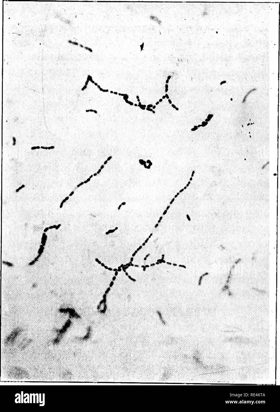 Streptococcus pyogenes bacteria Banque d'images noir et blanc - Alamy
