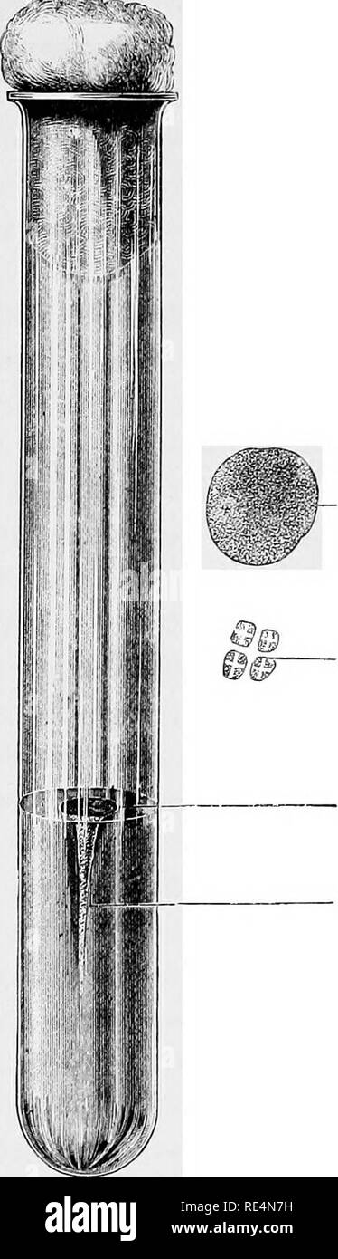 . Manuel de bactériologie pour les praticiens et les étudiants, notamment des références à des méthodes pratiques. La bactériologie. SARCINA VENTRICULI 247 couleurs, et ne décharge pas la tache en vertu de Gram's processus.. 'Lis colonie sur la gélatine * f- plate forme de la tétrade sarcina cultivés sur place superficielle gélatine aiguille voies Fig. 91-Thrust-Cdxture GtBLATike. dans d Sarcixa YEN'micuLi, quatre jours. La croissance de ce microbe n'affecte pas albuminoid, mais il a la propriété, d'autre part, de caséine et de pré- cipitating changement de sucre de lait en acide lactique. Veuillez noter que ces Banque D'Images