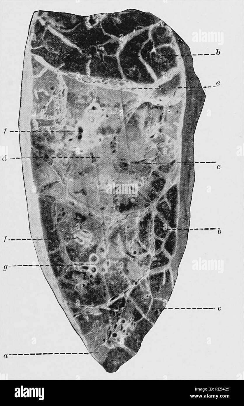 . Pathologie spéciale et la thérapeutique des maladies d'animaux domestiques. La médecine vétérinaire. La pathogénèse, les modifications anatomiques. 395 à travers le corps ; ceci est corroboré par l'expérience qu'en suçant les veaux les inflammations des articulations développer parfois par voie de métastase, et que, dans certains cas, le CCRVSI changements- teristic de pleuropneumonie contagieuse sont trouvés dans les poumons des fœtus des femmes enceintes malades les animaux. De toute évidence, le virus pathogène exerce son action par l'intermédiaire de toxines. Cette conception est supp6rted par le caractère de la proc- esses inflammatoire et de la fièvre, aussi par le fait Banque D'Images