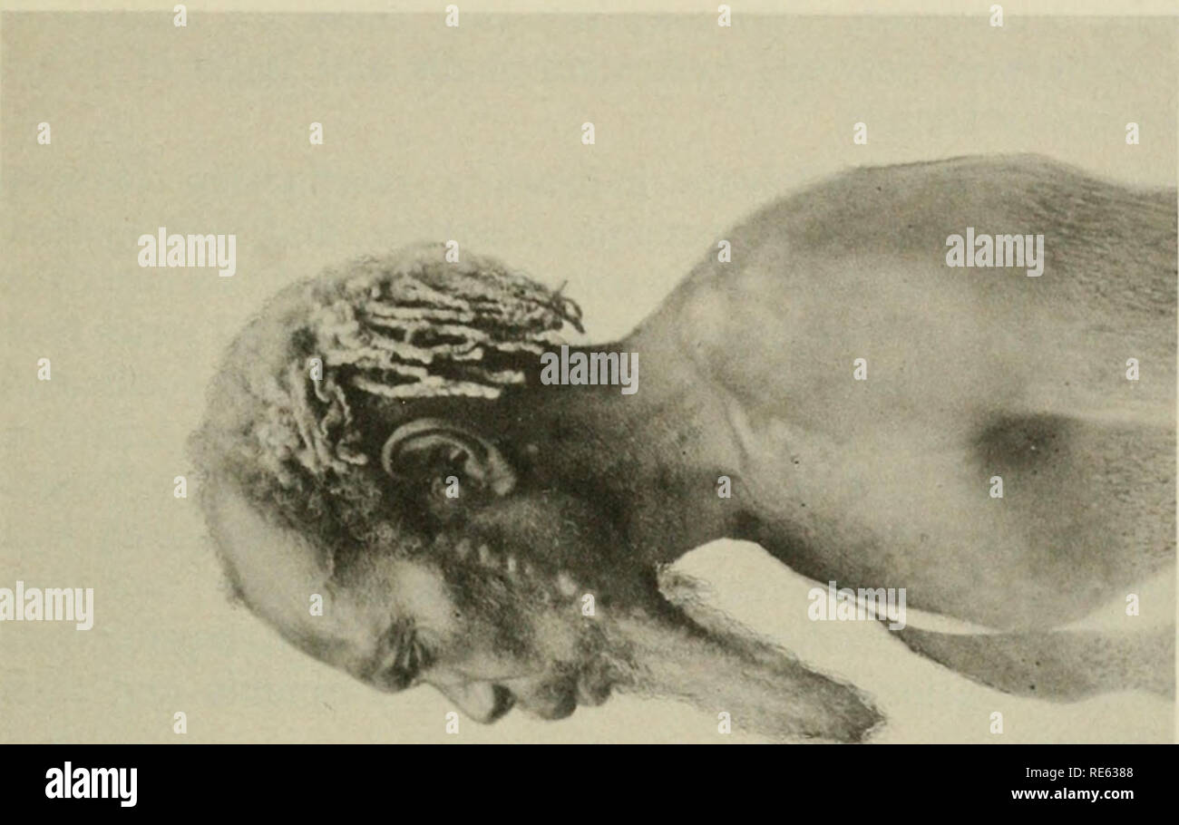 . Craniometry de Nouvelle Guinée.  ; Craniometry Craniology -- Guinée. . Veuillez noter que ces images sont extraites de la page numérisée des images qui peuvent avoir été retouchées numériquement pour plus de lisibilité - coloration et l'aspect de ces illustrations ne peut pas parfaitement ressembler à l'œuvre originale.. Hambly, Wilfrid Dyson, 1886-. Field Museum de Chicago : appuyez sur Banque D'Images