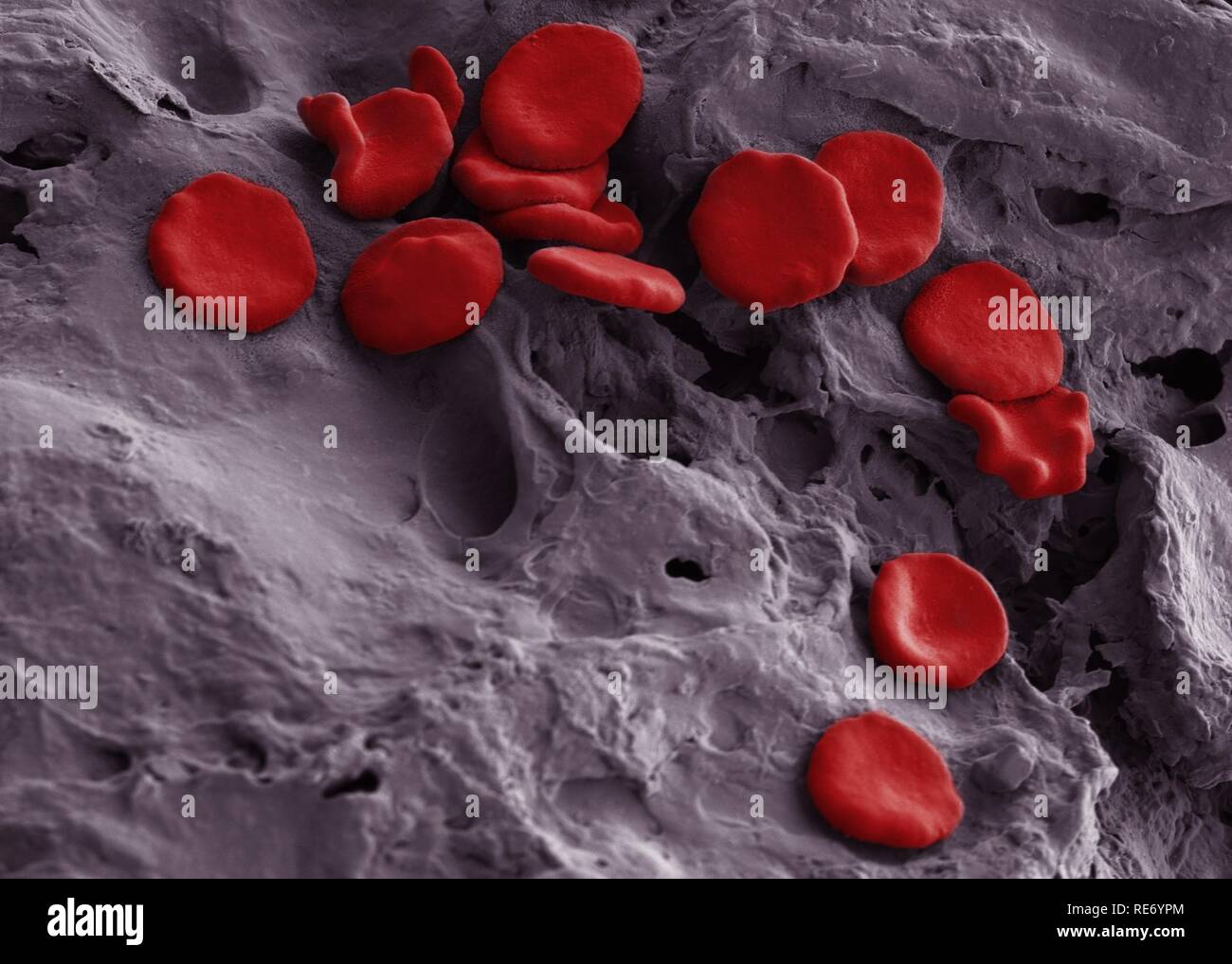 Glóbulos rojos de sangre humana. Fotografía BAM o SEM, con microscopio  electrónico de barrido. Se observan glóbulos rojos obtenidos de sangre  humana. Los glóbulos rojos también se denominan eritrocitos. Estas células  no