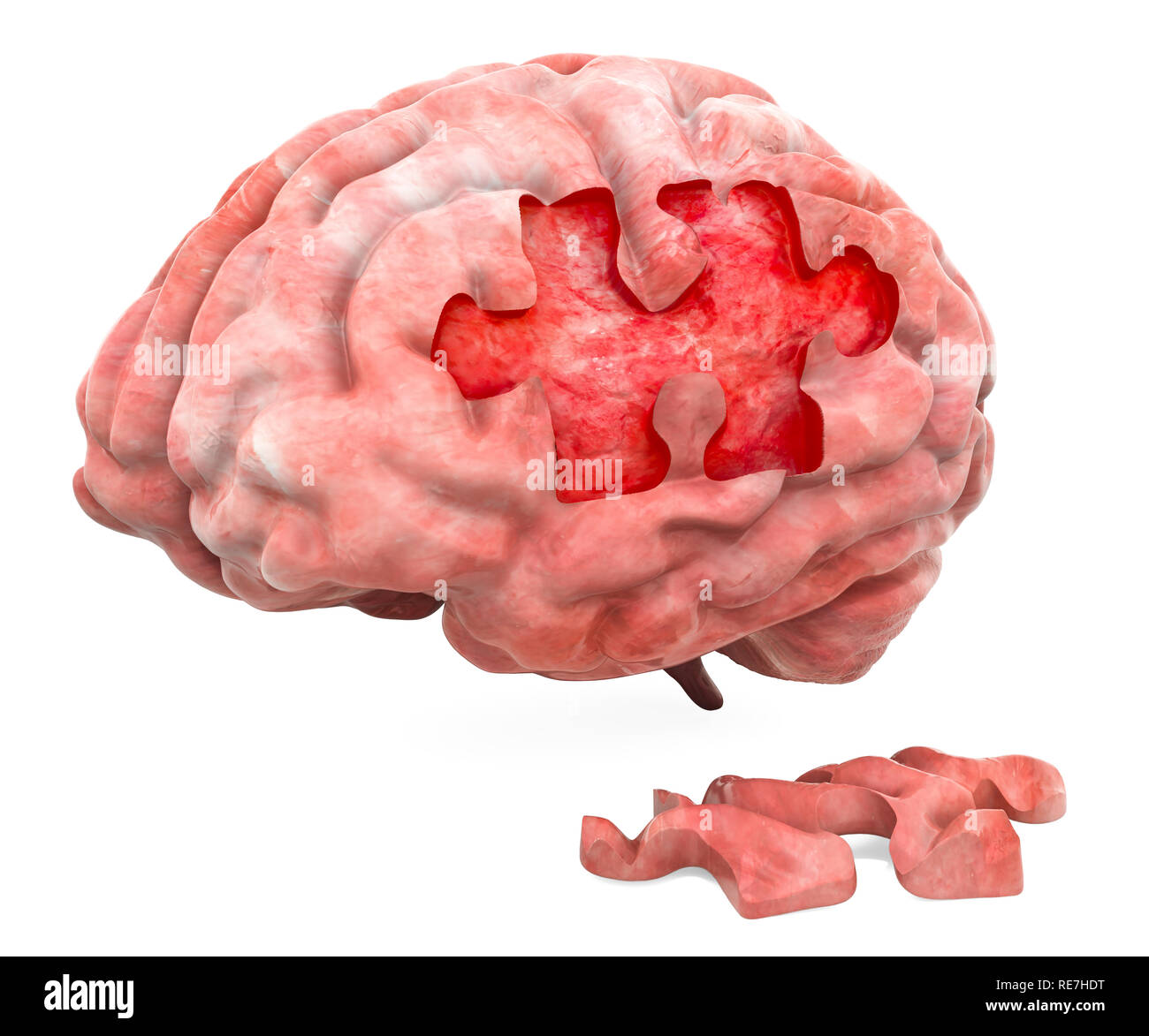 Maladies du cerveau ou la destruction concept. Le rendu 3D Banque D'Images