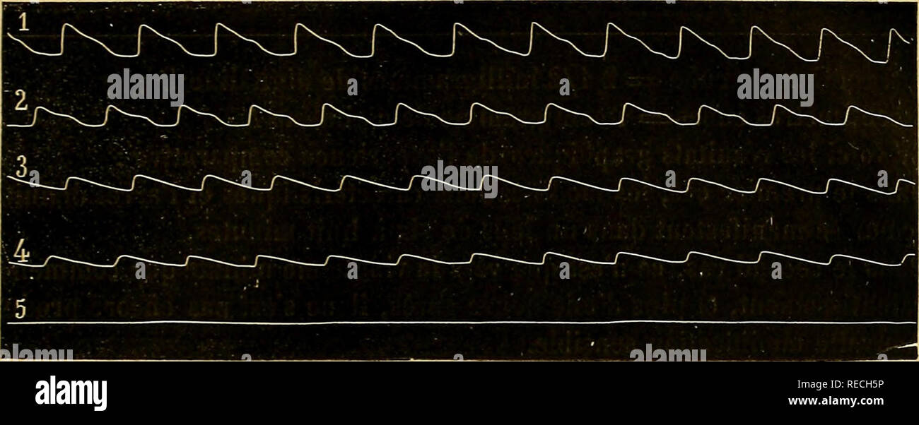 . Comptes rendus des séances de la Société de biologie et de ses filiales. La biologie. Fig. 1, â Digitaline D (english française), 5 milligrammes.  1, tracé normale, avant l'injection ; 2, 3, -1, immédiatement après l'injection ; 5, arrêt complet avec choix à la 5e minute.. Veuillez noter que ces images sont extraites de la page numérisée des images qui peuvent avoir été retouchées numériquement pour plus de lisibilité - coloration et l'aspect de ces illustrations ne peut pas parfaitement ressembler à l'œuvre originale.. La Société de biologie, Paris ; Société de biologie, Paris. Tous comptes rendus des séances et mémoires ; Soci Banque D'Images