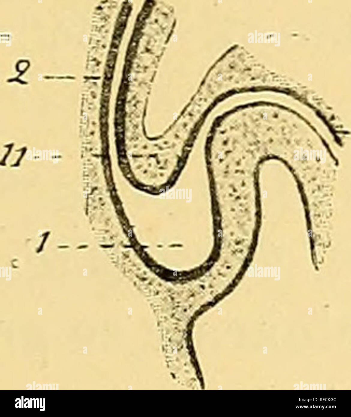 . Comptes rendus des séances de la Société de biologie et de ses filiales. La biologie. MALFORMATIONS CONGÉNITALES DE LA RÉGION ano-génitale 617 d'épispadias. Le sinus urogénital et le tube tube communiquent d'ailleurs ensemble par l'intermédiaire du cloaque. II. Malformations consécutives - un un développement anormal de la membrane cloacale ce deuxième groupe de malformations fœtales est caractérisé par ce fait que l'éperon périnéal, accomplissant son mouvement de descente, et séparant complè- tement le sinus urogénital du rectum, la membrane cloacale rencontre une anormalement développée. This membran Banque D'Images