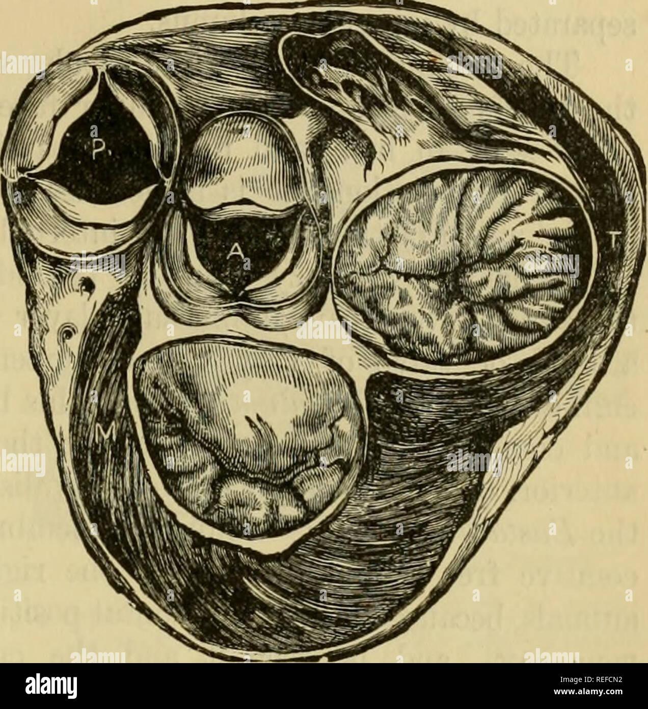 . L'anatomie comparée des animaux domestiques. Anatomie vétérinaire. TEE COEUR. ouverture ventriculaire, dont elle est séparée par une sorte d'épi musculaire, auquel est attaché le feston principal de la valve tricuspide. L'ouverture pulmonaire est meublé à trois-^ le sigmoïde (ou semi-lunaire), suspendu au dessus de l'entrée de l'artère pulmonaire, et, comme il a été fait remarquer ingénieusement (par Winslow), comme les nids de pigeons trois rejoint dans un triangle. Ces soupapes sont remarquables par leur maigreur-une circonstance qui n'interfère pas avec leur solidité. Ils présentent : un externe, Banque D'Images . L'anatomie comparée des animaux domestiques. Anatomie vétérinaire. TEE COEUR. ouverture ventriculaire, dont elle est séparée par une sorte d'épi musculaire, auquel est attaché le feston principal de la valve tricuspide. L'ouverture pulmonaire est meublé à trois-^ le sigmoïde (ou semi-lunaire), suspendu au dessus de l'entrée de l'artère pulmonaire, et, comme il a été fait remarquer ingénieusement (par Winslow), comme les nids de pigeons trois rejoint dans un triangle. Ces soupapes sont remarquables par leur maigreur-une circonstance qui n'interfère pas avec leur solidité. Ils présentent : un externe, Banque D'Images