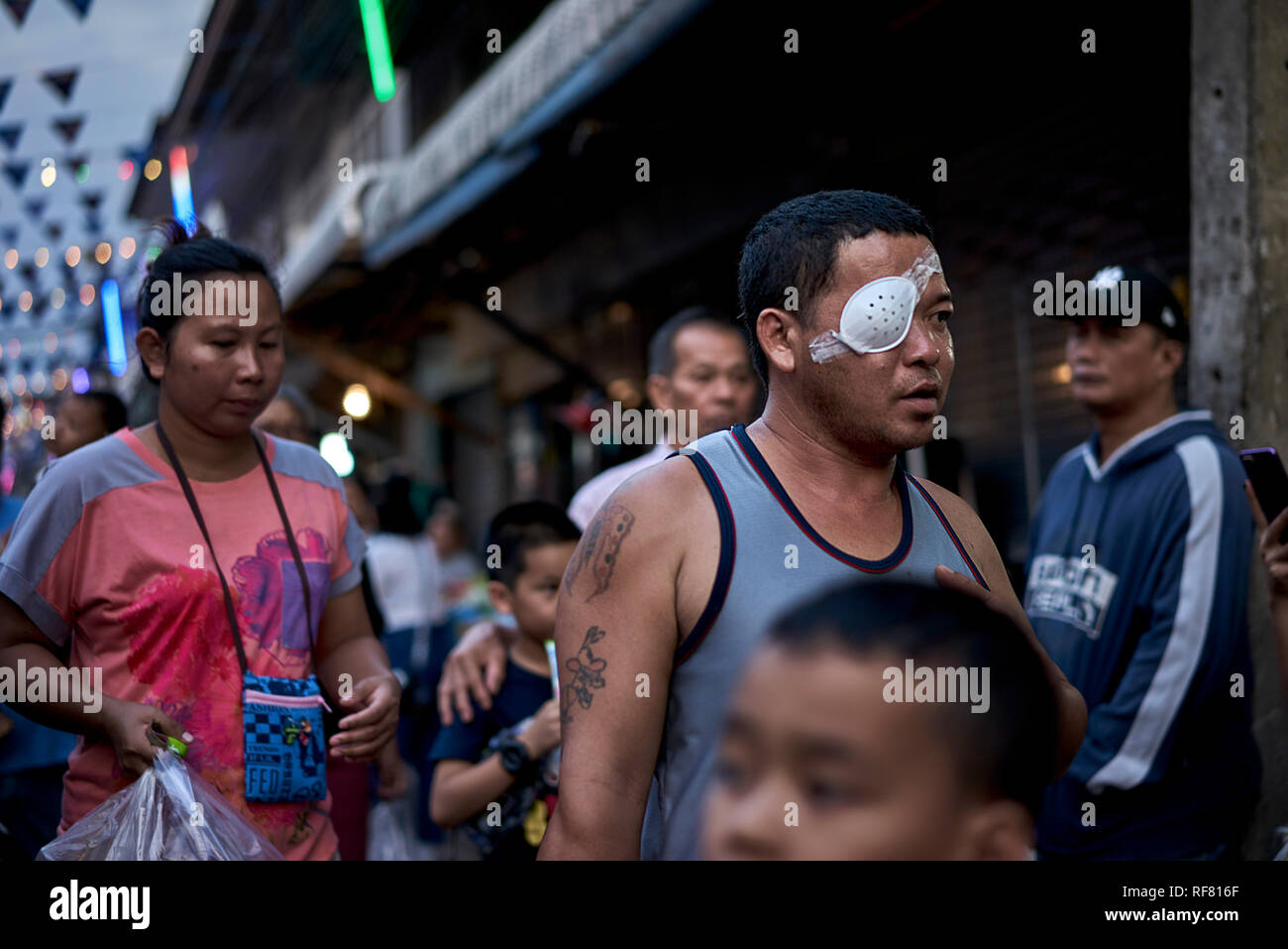 Blessure à l'œil. Un homme portant un bandeau de protection à l'extérieur dans la rue. La Thaïlande, en Asie du sud-est Banque D'Images