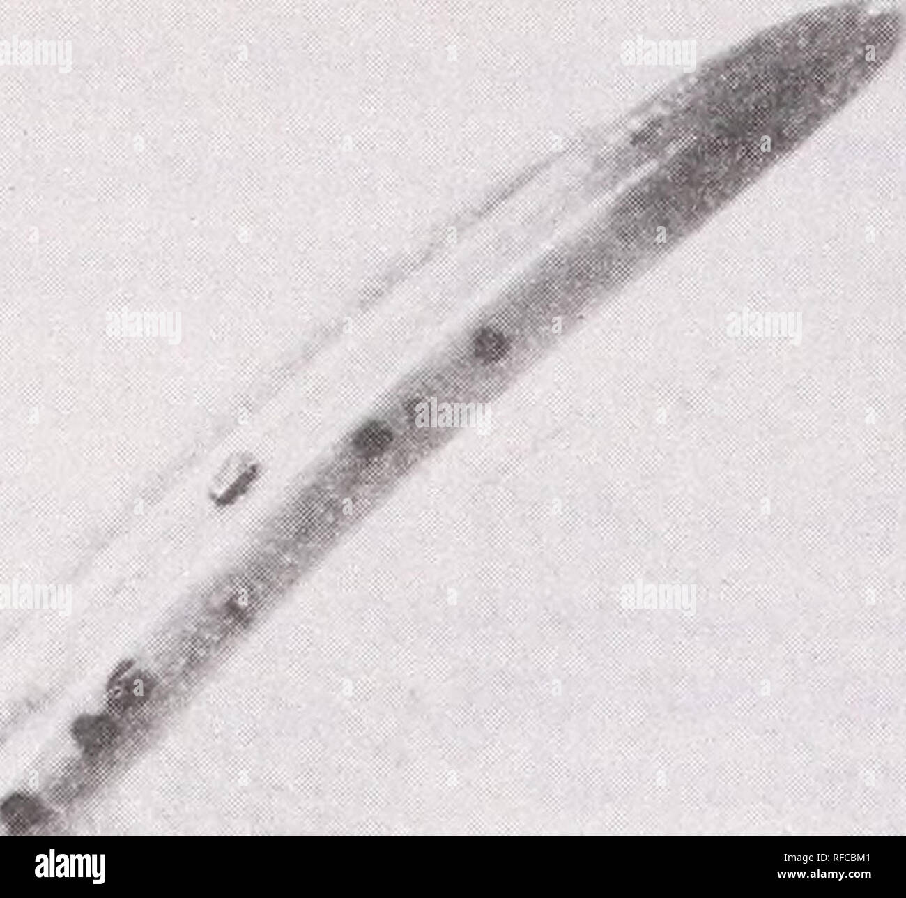 . De récentes recherches sur les maladies du feuillage : conference proceedings : Carlisle, Pennsylvanie, du 29 mai au 2 juin 1989. Maladies et ravageurs des feuilles United States Congrès. La figure 1-aiguilles recueillis le 28 octobre 1989, avec une pointe de vert et une base rouge-brun présentant des organes de fructification de Tiarosporella parca. Au cours de novembre et décembre la plupart des aiguilles ont été versées (5). Après beaucoup d'Aiguilles, rameaux minces, dépourvue d'aiguilles, n'a pu être observée, donnant à l'arbre l'aspect "lametta". Depuis 1984, nous avons inspecté plusieurs branches avec aiguilles rouge-brun. Très souvent, ces aiguilles ont été densément covere Banque D'Images