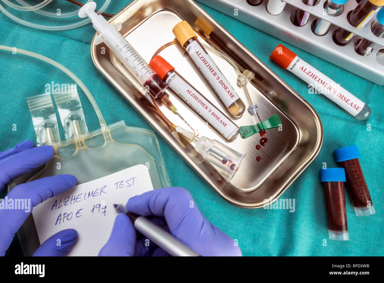 Scientist écrit à propos de marqueur sanguin sac d'enquêter sur les recours contre la maladie d'Alzheimer, conceptual image Banque D'Images