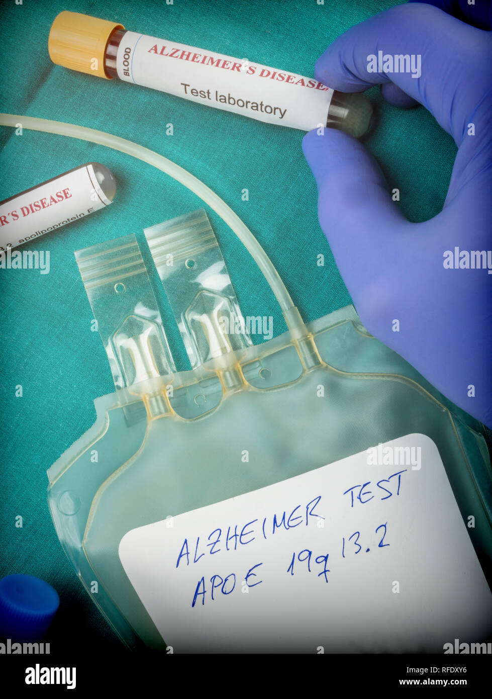 Chercheur scientifique est titulaire d'échantillon de sang d'enquêter sur les recours contre la maladie d'alzheimer, conceptual image Banque D'Images