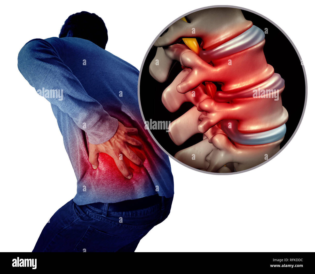 Douleurs au bas du dos ou dos et colonne vertébrale douloureuse concept  médical comme une personne ayant la région vertébrale douloureuse comme un  concept médical Photo Stock - Alamy