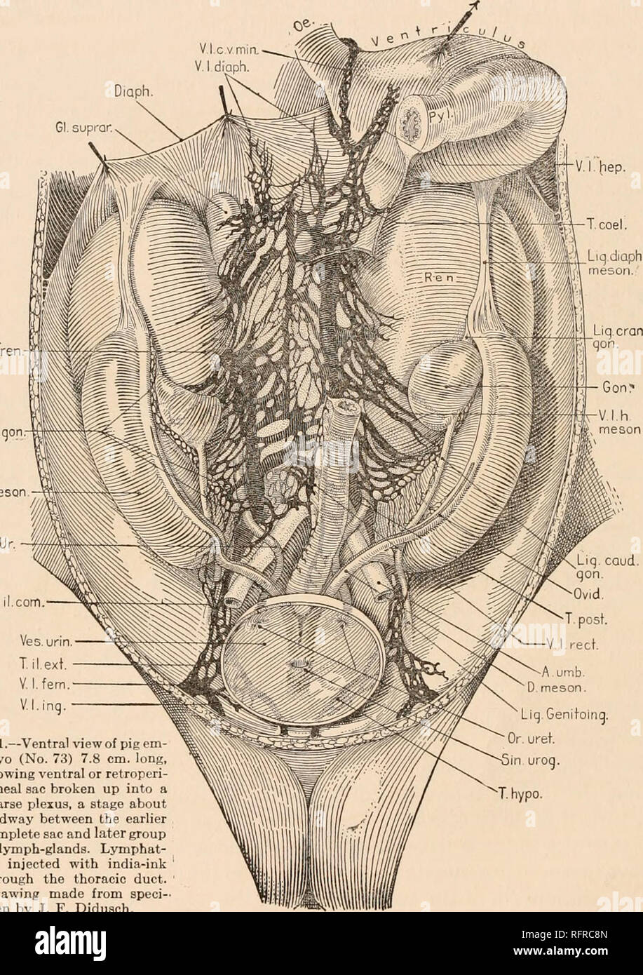 . Carnegie Institution of Washington publication. 22 SORT OP-SAC LYMPHATIQUE PRIMAIRE DANS LA RÉGION ABDOMINALE DE PORC, etc. Le grand tronc cœliaque (figs. 1 et 2, T. coel.) immédiatement se divise en une droite et une branche gauche, ce dernier bientôt entrer dans le tronc et la face mésiale tronc gauche. La gauche du tronc, qui comprend le tronc splénique gastro-, n'est pas indiqué dans la figure 1, être de l'autre côté de la pliure du mésentère, mais il peut être bien vu dans la figure 3. La masse des vaisseaux lymphatiques à l'extrémité antérieure du sac rétropéritonéal vers le cours sur une courte distance puis se tourne sur le ventre, en Banque D'Images