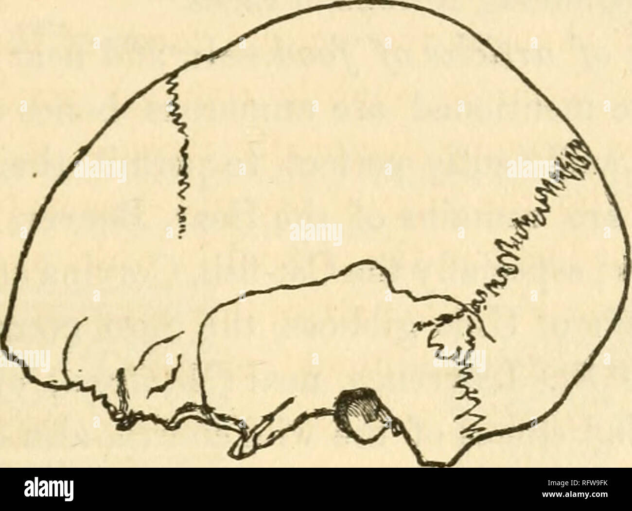 . Le naturaliste et géologue canadien. Histoire naturelle -- Périodiques. Note sur les antiquités, 433 moins allongée que dans No 1. Les os du visage sont fortes avec d'éminents zygoma, et la mâchoire inférieure est très massive. Les dimensions sont comme ci-dessus, la colonne (2). Ce spécimen, également avec le reste du squelette, est dans le Musée de l'histoire naturelle de la société. 3. Crâne d'un homme offed.-c'est en aspect général comme n°2. Ses dimensions sont comme ci-dessus, la colonne (3). Ce crâne est dans le Musée de l'avenue McGill College. Sa forme est illustrée à la fig. 1, 2 et 3.f. Fig. 1.. Veuillez noter que th Banque D'Images