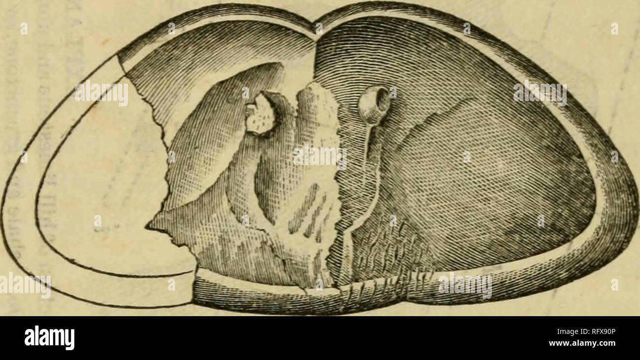 . Le naturaliste et géologue canadien. Histoire naturelle -- Périodiques. Trof, Hall sur un nouveau crustacé, 445 ; la frontière épaissie angles postérieurs arrondis. La marge est impressionné ou sinué à l'avant, et il y a de légères indications de rainures longitudinales de chaque côté de l'Europe centrale, laissant un lobe médian proportionnellement plus large que dans la limule. Les yeux, bien qu'imparfaite, rappellent un peu les yeux des Trilobites et sont remarquablement bien en vue.. Carapace d'jlglaspis au Wisconsin. Il y a un seul fragment de ce qui semble avoir été un ar- ticulation du thorax, ou une partie de som Banque D'Images