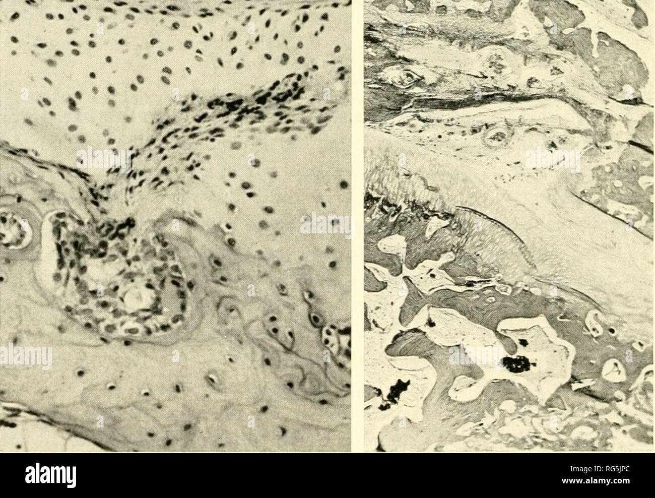 . Les tissus calcifiés ; procédures. Le collagène des os ; ; la calcification. Fig. la. Série I. no Lapin 033 ; 23 jours. Van Gieson. X57.5. Frontière interne de l'interligne articulaire de la tête fémorale. La congestion épiphysaire ; la modification de la plaque osseuse est très marquée. Un pannus coulisse sur le cartilage, en même temps que ce dernier est partiellement détruit par les pannus médullaire Fig. lb. Série I. no Lapin 033 ; 23 jours. Van Gieson. X47.5. Hyperplasie cellulaire ; la congestion et l'oedème du ligament croisé antérieur. L'érosion du cartilage. Fig. 2a. Série II. No lapin 103 ; 5 jours. L'ourlet.-éosine. X12S. Genou Banque D'Images