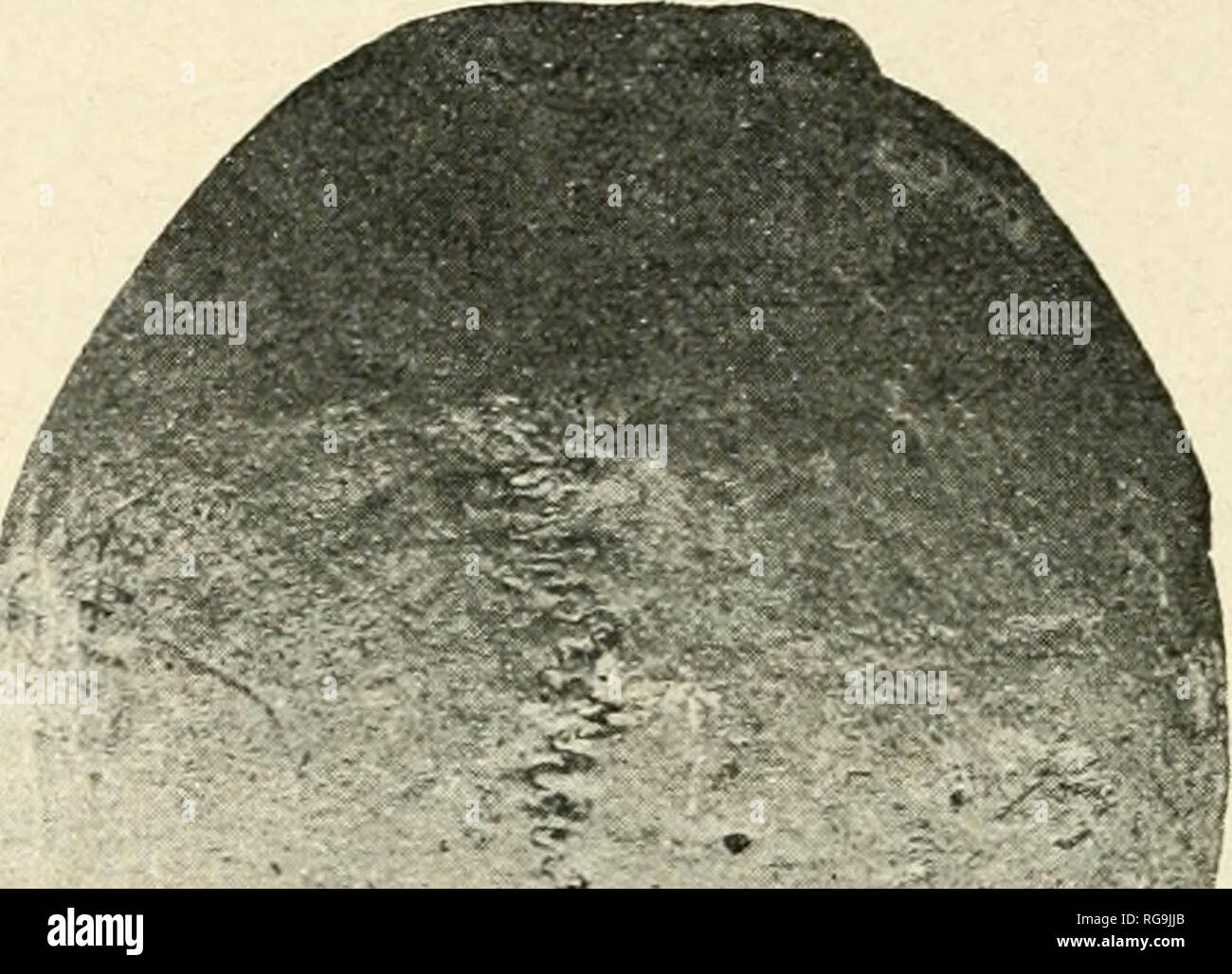 . Bulletin de la Société Vaudoise des sciences naturelles. Natural history ; histoire naturelle -- Suisse. r32 D*" ALEXANDRE SCHENK. j' y â yi-^ ; Fi/. 18. Â Cr;ine masculin n" 3. .Yorina verticulis. nient visible sur le cotÃ© droit du crÃ¢ne, grÃ¢ce un fort dÃ©veloppement de sa transversale rÃ©- gion antÃ©rieure. Les patrons pariÃ©tales sont faiblement marquÃ©es. Xoriud posteriora - cer (fig. Kj). (^ette vue montre encore un crÃ¢ne Ã©levÃ©, Ã sinciput Courvoisier, fa i b 1 e m e n l hvpsicÃ©phale. Les bos- ses cÃ©rÃ©brales de l'oc- cipital forment une lÃ©- gÃ¨re saillie et la dila- tatio Banque D'Images