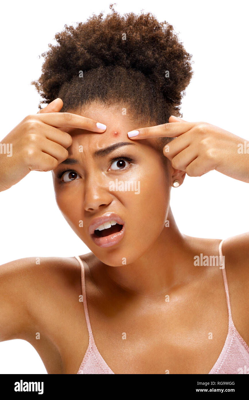 Jeune fille en état de choc de son acné. Photo de african american girl with problem skin sur fond blanc. Concept de soins de la peau Banque D'Images