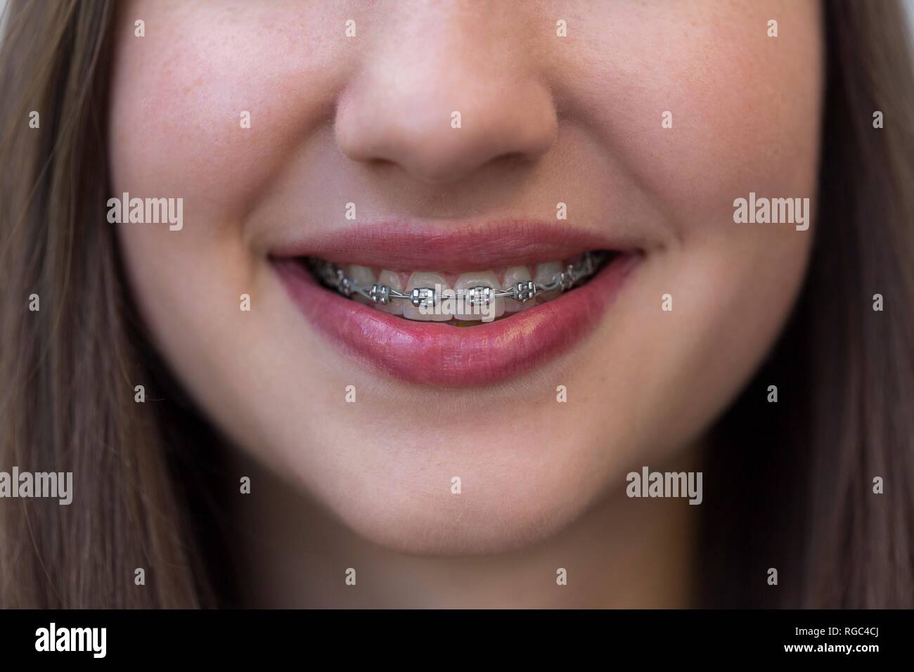 Close-up of smiling teenage girl with braces Banque D'Images