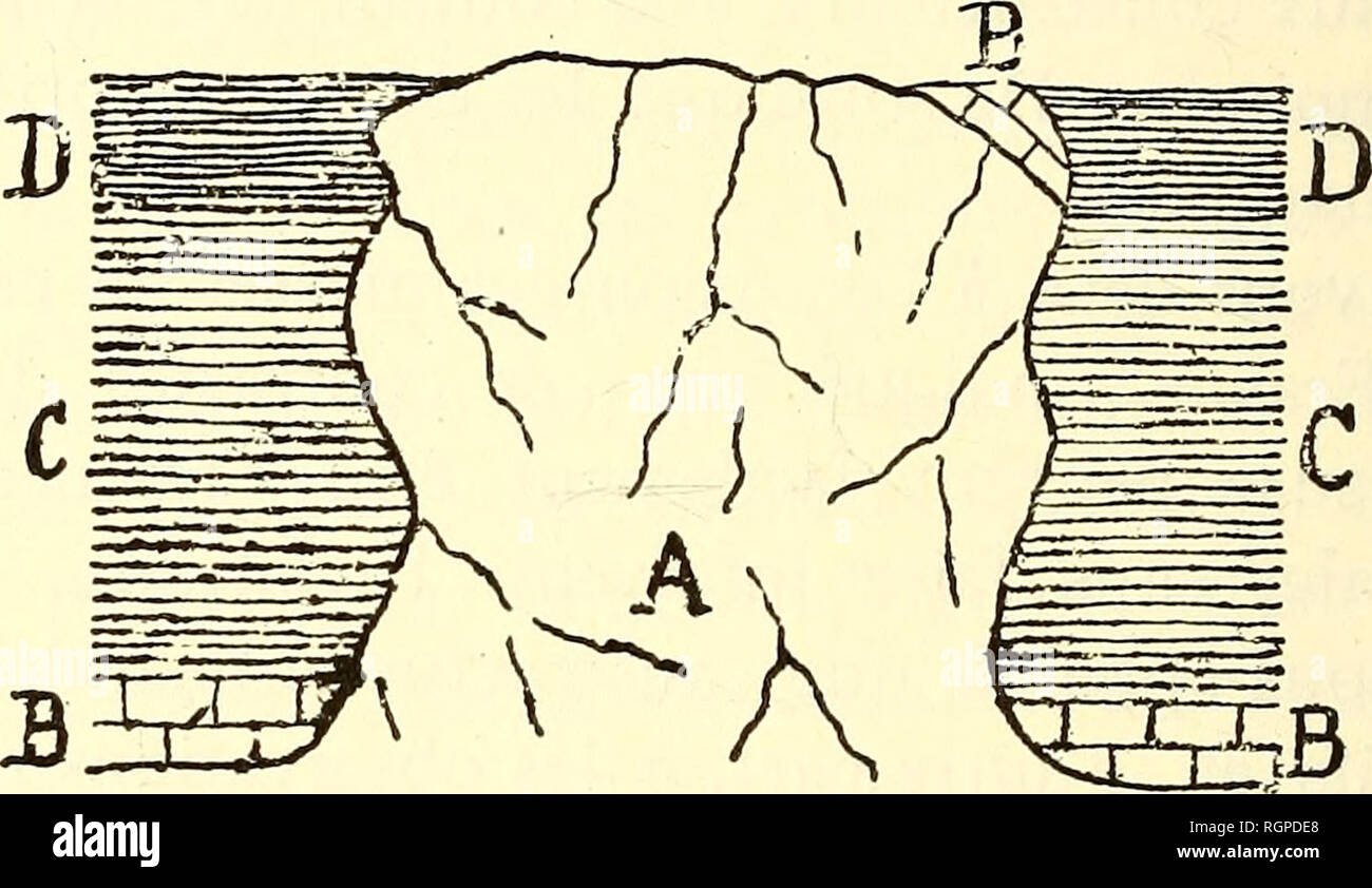 . Bulletin de la SociÃ©tÃ© belge de gÃ©ologie, de palÃ©ontologie et d'hydrologie. La géologie, la paléontologie. 198 Ã. DUPONT. Â Les calcaires et schistes mÃªme tertre : plusieurs de ces cas se produisent simultanÃ©ment dans la ceinture©o calcarÃ-schisteuse de ces petites masses coralliennes. Si nous prenons, par exemple, l'un des rÃ©cifs des Terniats, nous pouvons nous le reprÃ©senter Ã l'origine avec les dispositions suivantes : FlG. 7. Â FigurÃ© interprÃ©tatif de la bordure schisteuse d'un des rÃ©cifs de calcaire rouge des Terniats dans sa disposition originaux- naire.. A. RÃ©cif de calcaire rouge. B. Banque D'Images