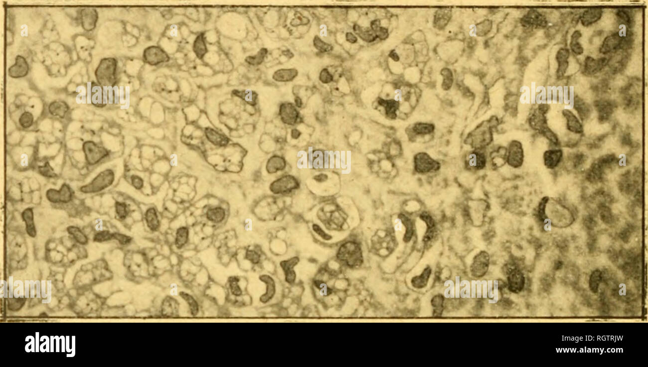 Neurites Banque D Image Et Photos Alamy