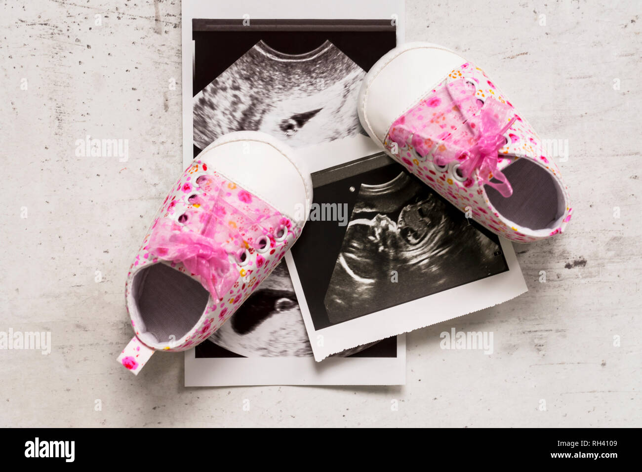 Pink Booties En Regard Des Photos Du Bebe A L Echographie A 4 Et Semaines De Grossesse Le Concept D Avoir Un Bebe Fille La Grossesse Fille S Photo Stock Alamy