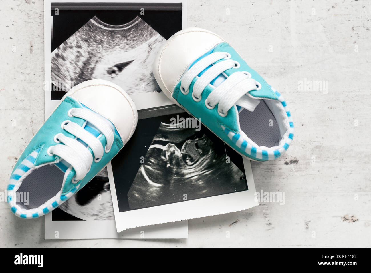 Chaussures Bleu A Cote Des Photos De Bebe Avec Des Ultrasons A 4 Et Semaines De Grossesse Le Concept De L Attente De Bebe La Grossesse Un Fils Selective Focus Photo Stock