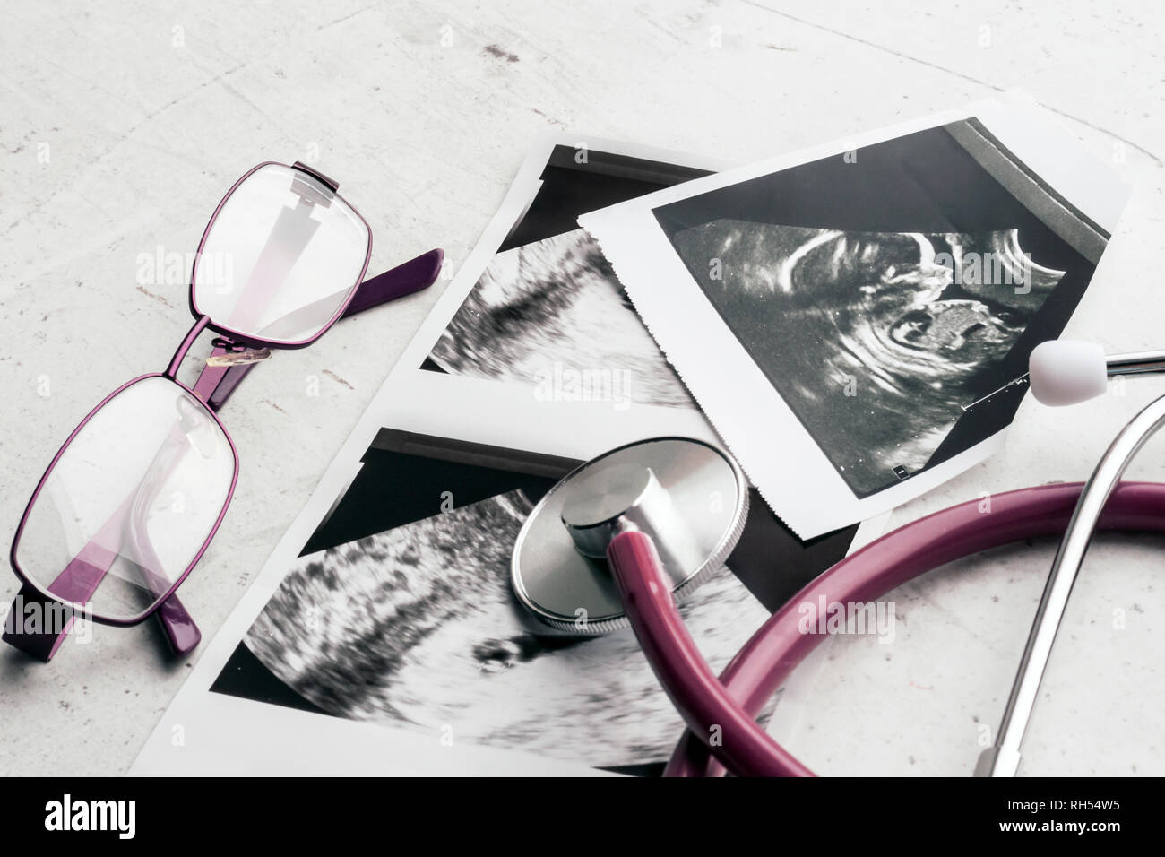 Phonendoscope vs stéthoscope et verres se situent sur des images d