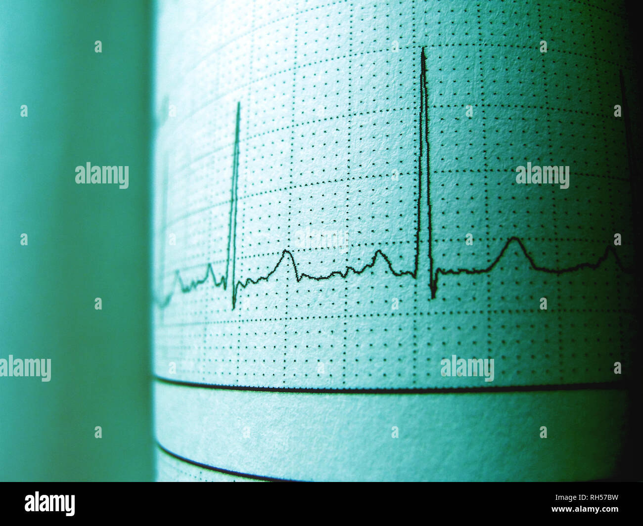 Un rythme cardiaque sinusal sur l'enregistrement de l'électrocardiogramme montrant le papier de l'onde P Normal, communication et de l'intervalle QT et des complexes QRS, papier d'un électrocardiogramme. Banque D'Images