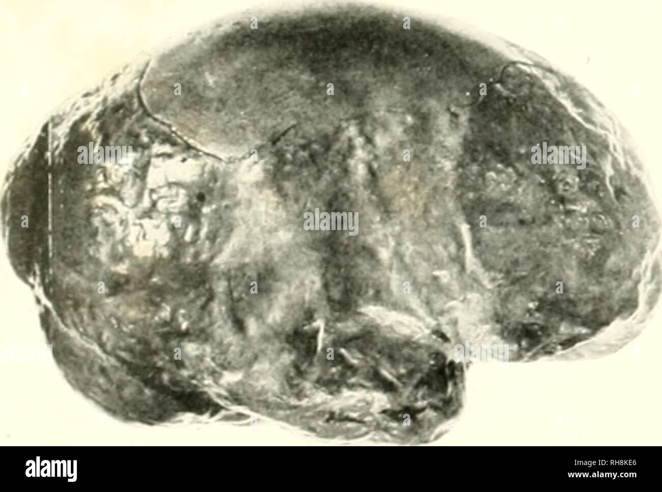 . Le cerveau de singe à l'homme ; une contribution à l'étude de l'évolution et le développement du cerveau humain. Cerveau ; évolution ; Pongidae. . Veuillez noter que ces images sont extraites de la page numérisée des images qui peuvent avoir été retouchées numériquement pour plus de lisibilité - coloration et l'aspect de ces illustrations ne peut pas parfaitement ressembler à l'œuvre originale.. Tilney, Frédéric, 1875-1938 ; Riley, Henry Alsop, 1887-. New York, P. B. Hoeber, inc. Banque D'Images