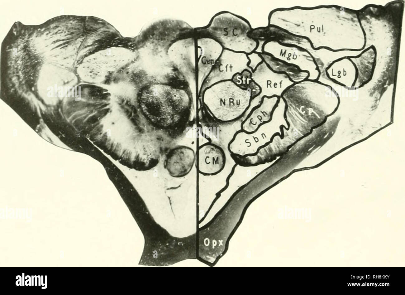. Le cerveau de singe à l'homme ; une contribution à l'étude de l'évolution et le développement du cerveau humain. Cerveau ; évolution ; Pongidae. 834 cerveaux de l'homme. Le intcrcoUicular entre le sillon colliculi supérieurs est plus vaste et plus profonde que dans le les anthropoïdes. Il forme une grande fosse pour l'épiphyse pinéale. d'hypertension La fonction attribuée à l'épiphyse en inhibant la croissance et. FIG. 356. L'HOMME. LE EL DU CHIASMA OPTIQUE. Le CEN, la matière grise centrale ; cm, Mammillary Corps ; cp ; pédoncule cérébral, Cph, Corpus Hypothalamicum ; CFT, Central Tegmental Voies respiratoires ; de LCB. Corps corps genouillé latéral, MGB, Mésial Geni Banque D'Images