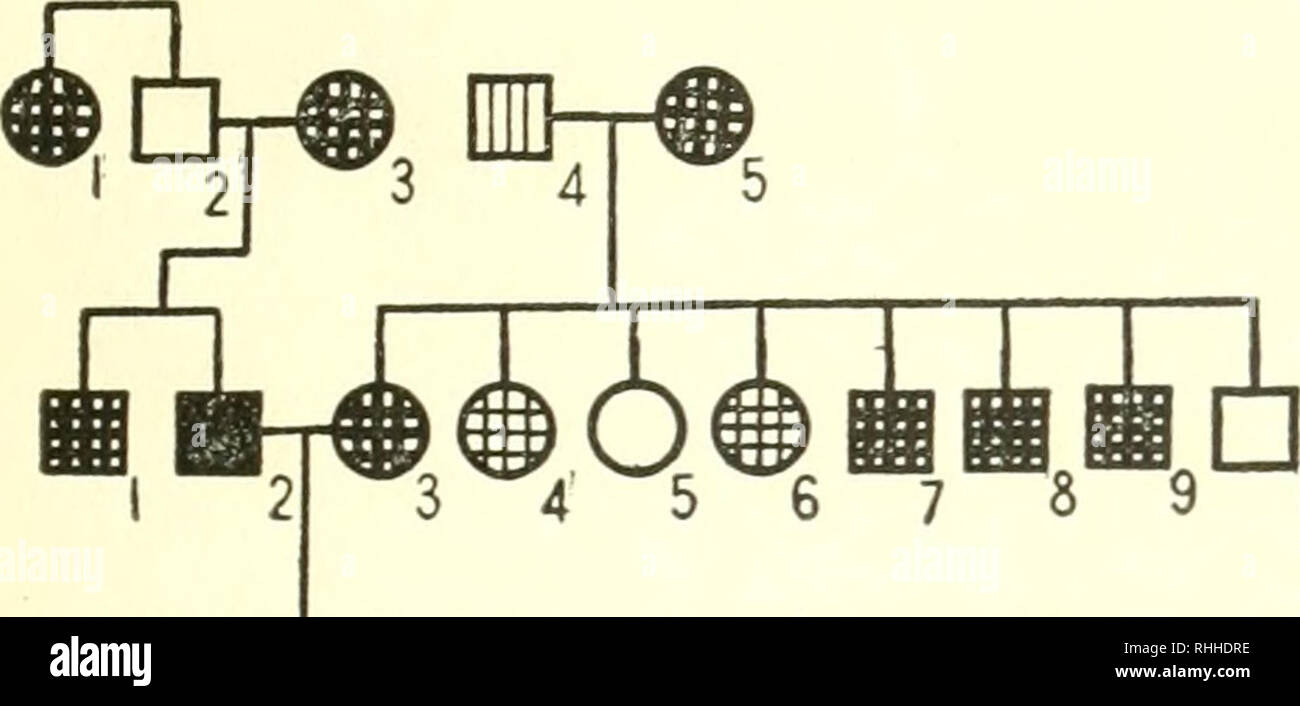 . Corps-construction et son héritage. L'hérédité, l'anatomie humaine. L'ARRIÈRE CROIX. 137 m c Loisir Famille, B. (Fig. 47.) Mauvais 1 $, charnue, avec un père et mère mince, marié à III 2 $ (9, fig. 2), qui, à 53 ans, a une envergure de 150 cm. (59 pouces) et le poids de beaucoup plus de 90 kg. (200 livres) ; construction 4.0 (57) ; l'obésité. Son thorax est relative 2,40 135-^150, soit 90  % ; obèse. extraordinaire À 16 ans, une fois mariée, elle pesait 110 livres ; construire 2,2 (32) ; moyennes. 4 de ses 4 frères et les deux parents sont excessivement obèses (sa mère pèse 163 kg. [360 livres] et a une accumulation de 7,0 [100]). Banque D'Images