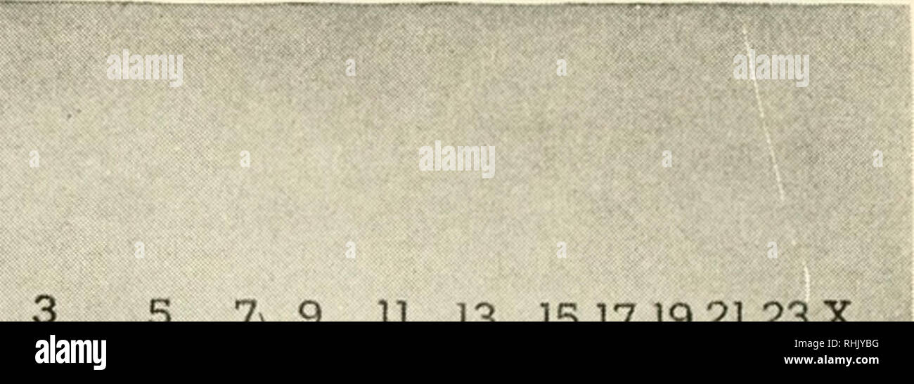 . La biologie et l'homme. Biologie ; les êtres humains. 5, 79 11 13 13 15 17 19 21 23 X 4' 68' 10' 12 14 16 18 20 22 Y I'aililrl dans les chromosomes de l'homme 24 paires de chromosomes sont indiqués par ordre de taille. Les membres de chaque paire ore indiscernables, sauf que le plus petit, marqué X et Y, diffèrent en taille chez le mâle. Au cours de la division de réduction, lorsque les cellules du sperme sont en cours de formation, l'X va à un sperme et le Y à l'autre. Tous les oeufs, cependant, ont le chromosome X. Variations structurels qui le microscope peut révéler chez les chromosomes de différents individus ne peuvent pas être liées aux renseignements personnels ou rac Banque D'Images