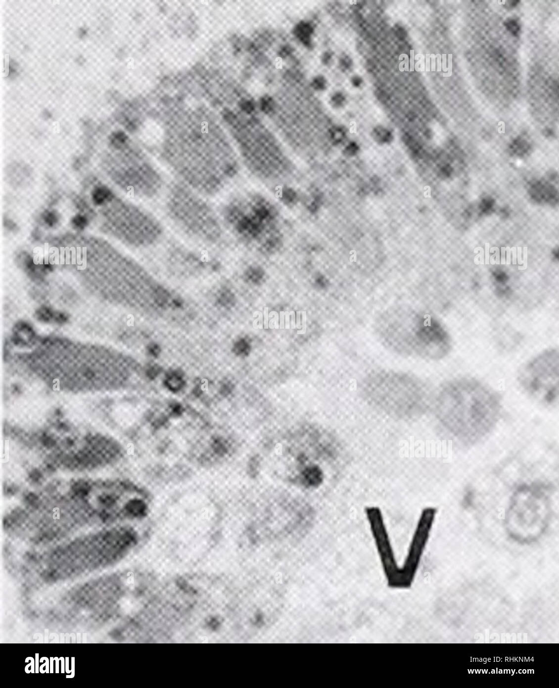 . Le bulletin biologique. Biologie ; zoologie ; biologie ; biologie marine. Métamorphose d'éponge calcaire 21 ils sont perdus par l'exfoliation au cours de la phagocytose ou méta- morphosis (Bergquist et Glasgow 1986 : Misevic et al., 1990 ; Kaye et Reiswig, 1991). Les cellules flagellées dans le coeloblastulae des éponges calcaires ne peut, toutefois, être écartée, car ces cellules constituent la plus grande partie de la larve. Le coeloblastulae des éponges calcaires ont été stud- ied très rarement, et nous en savons très peu sur le processus de leur métamorphose (Minchin. 1896 ; Tuzet, 1947 ; Borojevic, 1969). Dans ce stu Banque D'Images