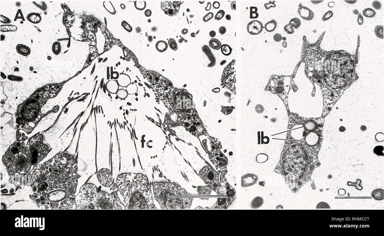 . Le bulletin biologique. Biologie ; zoologie ; biologie ; biologie marine. Les voies de transport éponge 37. La figure 5. Cordon Latex absorption par ,4/j/v.w suis ; fuiiliforniis (microscopie électronique à transmission). (A) Quatre heures après l'alimentation, de billes de latex (Ib) ont été trouvés dans les chambres flagellées (FC) et (B) dans les cellules dans le mesohyl ameboid. Bar (A) : 17 h : (B) : 2 h. Les tentatives d'enregistrer le mouvement de cellules dans le tissu brins de Aplysina ont été entravés par l'opacité du tissu ; en effet, les brins uniquement les cellules sur les bords des volets pourraient être surveillés par la microscopie. Con- conséquence, éléments qui ont été e Banque D'Images