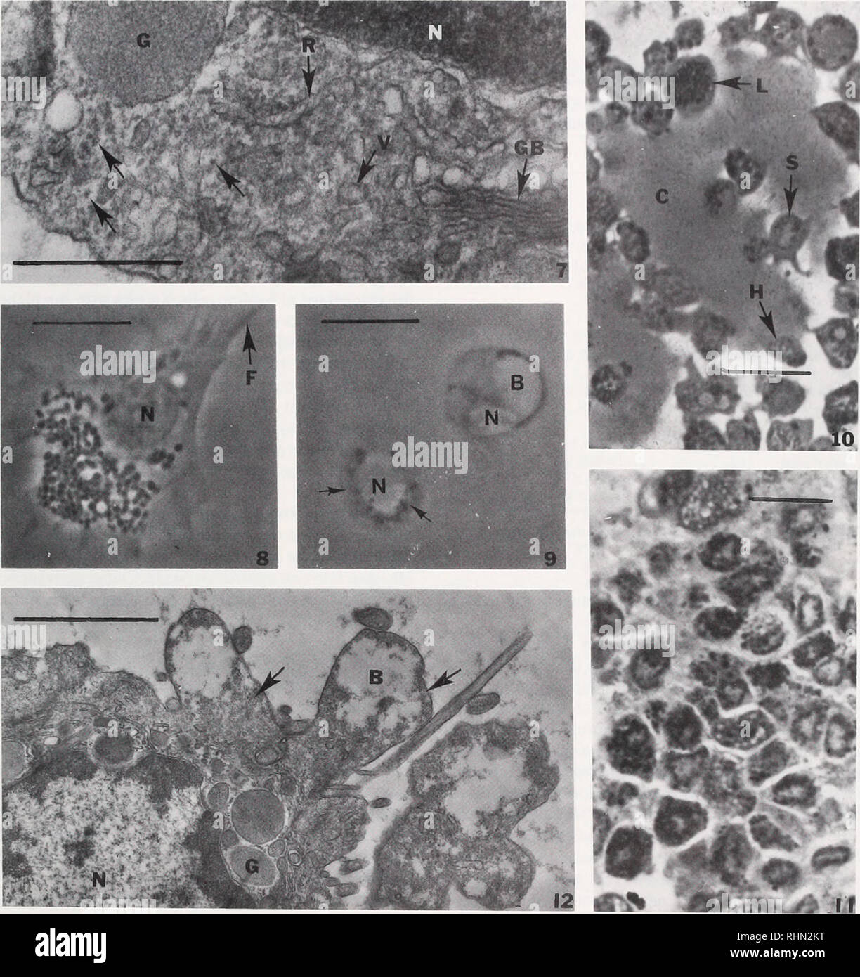 . Le bulletin biologique. Biologie ; zoologie ; biologie ; biologie marine. La figure 7. Micrographie électronique à transmission d'un americanux d'hémocytes hyalines de Homarus spectacle- ing dépôts cytoplasmiques (flèches), RER (R), un moyen (G). vésicules (V), noyau (N). et au bord du corps de Golgi (GB). X 70 000  = 0,5 bar ; échelle ^m. La figure 8. Micrograph Light d'un grand de Pamdinis inlemiptux d'hémocytes granulaires 2 min après mélange des volumes égaux de l'hémolymphe et de mer contenant bleu trypan. Remarque La cellule est intact et s'est répandue sur le substrat de verre. Noyau (N) ; filopodes(F). 2000X ; barre d'échelle  = 10 ^m. La figure 9. Li Banque D'Images