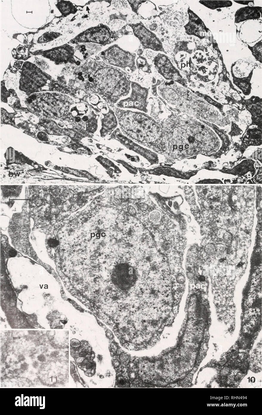 . Le bulletin biologique. Biologie ; zoologie ; biologie ; biologie marine. 286 M. S. HOUK et R. T. HINEGARDNER. La figure 9. Coupe dans le primordium génital d'un oursin vert 0,5 mm de diamètre montrant le mesentary m'épithélium, avec son sous-sol sous-jacent (flèche), des lamelles de cellules germinales primordiales pgc, de présomption de cellules accessoires [&gt;ac. et une cellule phagocytaire /&gt ;/i. L'épithélium du mésentère se joint à celui de la paroi du corps /w à la partie inférieure droite de la figure. Bar  = 1 fj.m.. Veuillez noter que ces images sont extraites de la page numérisée des images qui peuvent avoir été retouchées numériquement pour Banque D'Images