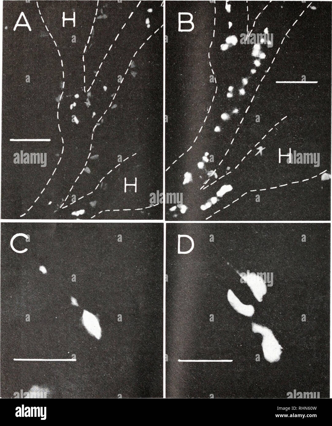 . Le bulletin biologique. Biologie ; zoologie ; biologie ; biologie marine. 402 J. G. MORIN et G. T. Reynolds. La figure 3. Microscope à fluorescence des photographies de la vie Obelia gcniculata. (A). Partie basale d'une position verticale montrant trois nœuds, chaque nœud et montre une grappe de pédicelle photocytes. Le contour du squelette de l'hydroïde a été parsemé de blanc. Hydranths sont indiqués par un H. Le matériau fluorescent dim autour des photocytes sont fluorescentes rouges diatomées attaché à l'hydroïde. (B). La partie distale de la verticale montrant deux nœuds ; noter les plus nombreux photocytes qu'en (A) et le peu de diat Banque D'Images