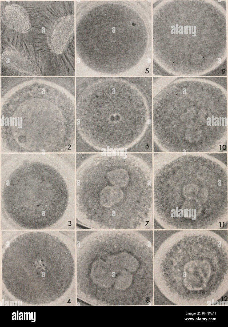 . Le bulletin biologique. Biologie ; zoologie ; biologie ; biologie marine. 116 C. R. AUSTIN. Toutes les photos ont été prises par la microscopie en contraste de phase et sont reproduits à X 1300. La figure 1. Les paquets de sperme. (Matériel Frais.) FIGURE 2. L'ovocyte primaire avec intact vésicule germinale. Un spermatozoïde étaient entrés récemment dans l'œuf (en haut). (Matériel Frais.). Veuillez noter que ces images sont extraites de la page numérisée des images qui peuvent avoir été retouchées numériquement pour plus de lisibilité - coloration et l'aspect de ces illustrations ne peut pas parfaitement ressembler à l'œuvre originale.. Laboratoire de Biologie Marine (Bois Banque D'Images